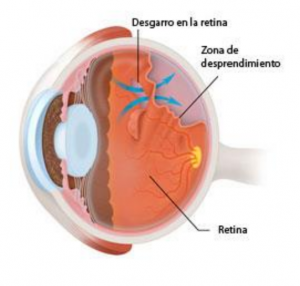 Captura-de-pantalla-2018-10-05-a-las-13.38.23-300x286